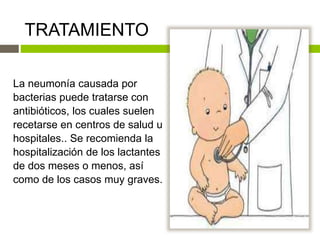 TRATAMIENTO
La neumonía causada por
bacterias puede tratarse con
antibióticos, los cuales suelen
recetarse en centros de salud u
hospitales.. Se recomienda la
hospitalización de los lactantes
de dos meses o menos, así
como de los casos muy graves.
 