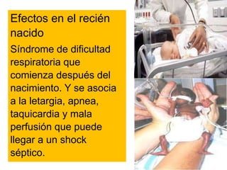 Efectos en el recién
nacido
Síndrome de dificultad
respiratoria que
comienza después del
nacimiento. Y se asocia
a la letargia, apnea,
taquicardia y mala
perfusión que puede
llegar a un shock
séptico.
 