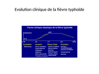 Evolution clinique de la fièvre typhoïde
 