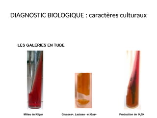 DIAGNOSTIC BIOLOGIQUE : caractères culturaux
Milieu de Kliger Production de H2S+
Glucose+, Lactose - et Gaz+
LES GALERIES EN TUBE
 