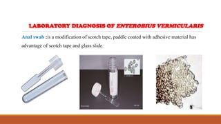 Anal swab :is a modification of scotch tape, paddle coated with adhesive material has
advantage of scotch tape and glass slide.
LABORATORY DIAGNOSIS OF ENTEROBIUS VERMICULARIS
 