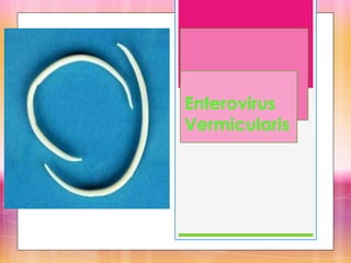 Enterovirus
Vermicularis
 
