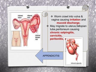  Worm crawl into vulva &
vagina causing irritation and
mucoid discharge.
 May migrate to uterus,fallopian
tube,peritoneum causing
chronic salpingitis,
cervicitis,
peritonitis,recurrent UTI.
APPENDICITIS
 