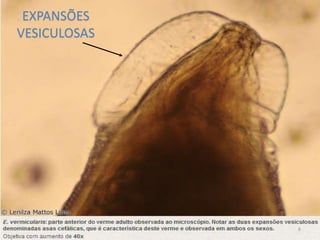 EXPANSÕES
VESICULOSAS
6
 