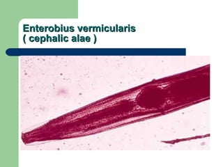 Enterobius vermicularis ( cephalic alae ) 