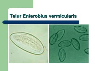 Telur Enterobius vermicularis 