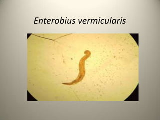 Enterobius vermicularis
 