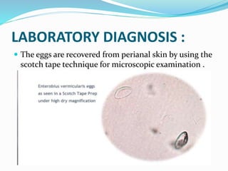 Enterobius vermicularis(pin worm) | PPTX