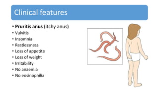 Clinical features
• Pruritis anus (itchy anus)
• Vulvitis
• Insomnia
• Restlessness
• Loss of appetite
• Loss of weight
• Irritability
• No anaemia
• No eosinophilia
 