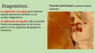 Diagnóstico.
La aspiración con aguja para obtener
líquido peritoneal también es un
auxiliar diagnóstico.
La obtención de líquido café y amarillo
Pardo microorganismo en la tincion
gram es muy sugestiva de gangrena
intestinal.
Punción peritoneal (cuadrante inferior
izquierdo)
 
