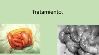 Tratamiento.
 
