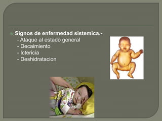    Signos de enfermedad sistemica.-
     - Ataque al estado general
     - Decaimiento
     - Ictericia
     - Deshidratacion
 