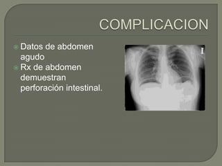  Datos   de abdomen
  agudo
 Rx de abdomen
  demuestran
  perforación intestinal.
 
