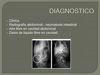    Clinica
   Radiografia abdominal.- neumatosis intestinal
   Aire libre en cavidad abdominal
   Datos de liquido libre en cavidad.
 