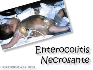 Enterocolitis
                                 Necrosante
Curiel Martínez Vania Lizette
 