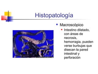 Histopatología
 Macroscópico
 Intestino dilatado,
con áreas de
necrosis,
hemorragia, pueden
verse burbujas que
disecan la pared
intestinal y
perforación
 