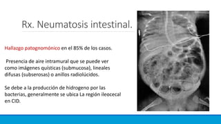 Rx. Neumatosis intestinal.
Hallazgo patognomónico en el 85% de los casos.
Presencia de aire intramural que se puede ver
como imágenes quísticas (submucosa), lineales
difusas (subserosas) o anillos radiolúcidos.
Se debe a la producción de hidrogeno por las
bacterias, generalmente se ubica La región ileocecal
en CID.
 