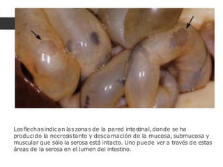 Lasflechasindican laszonas de la pared intestinal, donde se ha
producido la necrosistanto y descamación de la mucosa, submucosa y
muscular que sólo la serosa está intacto. Uno puede ver a través de estas
áreas de la serosa en el lumen del intestino.
 