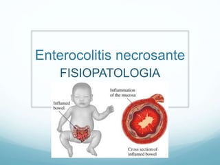Enterocolitis necrosante
FISIOPATOLOGIA
 
