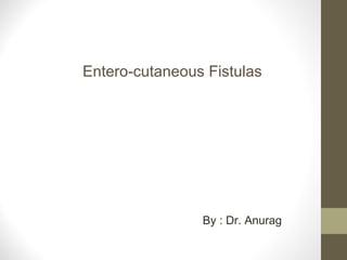 Entero-cutaneous Fistulas
By : Dr. Anurag
 