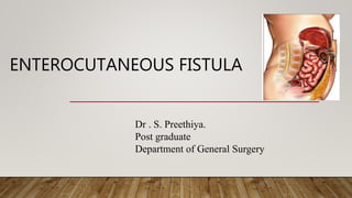ENTEROCUTANEOUS FISTULA
Dr . S. Preethiya.
Post graduate
Department of General Surgery
 