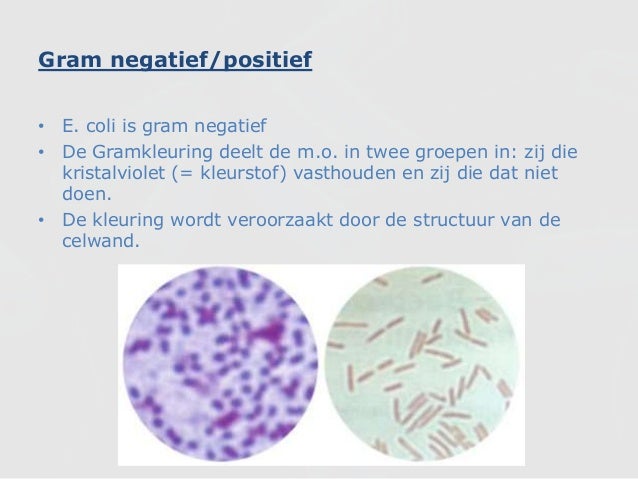 Enterohemorragische Escherichia coli (O157:H7) (shared using http://V…