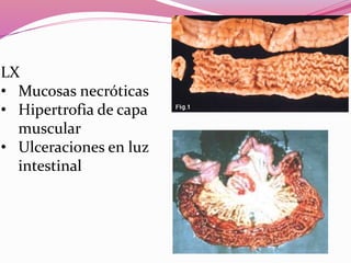 LX
• Mucosas necróticas
• Hipertrofia de capa
muscular
• Ulceraciones en luz
intestinal
 