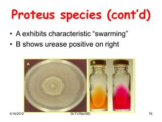 Proteus species (cont’d)
• A exhibits characteristic “swarming”
• B shows urease positive on right
4/16/2012 Dr.T.V.RaoMD 76
 