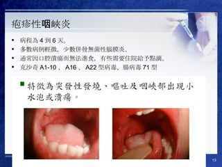 疱疹性咽峽炎 病程為 4 到 6 天。 多數病例輕微，少數併發無菌性腦膜炎。 通常因口腔潰瘍而無法進食，有些需要住院給予點滴。 克沙奇 A1-10 、 A16 、 A22 型病毒、腸病毒 71 型 
