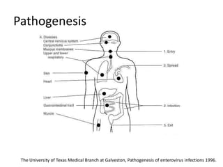 Pathogenesis




 The University of Texas Medical Branch at Galveston, Pathogenesis of enterovirus infections 1996.
 