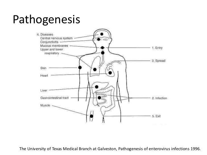 Enteroviruses Enteroviruses