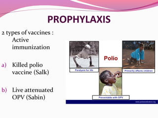 PROPHYLAXIS
2 types of vaccines :
Active
immunization
a) Killed polio
vaccine (Salk)
b) Live attenuated
OPV (Sabin)
www.polioeradication.org
Polio
Paralysis for life Primarily affects children
Preventable with OPV
 
