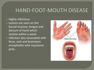 Entovirus Rash Entero virus infections | PPTX