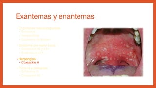 Exantemas y enantemas
• Erupciones maculopapulares
• Echovirus
• Inespecíficas
• Exantema de Boston
• Síndrome pie-mano-boca
• Coxsackie A6 y A16
• Enterovirus A71
• Herpangina
• Coxsackie A
• Púrpura y petequias
• Echovirus 9
• Coxsackie A9
 