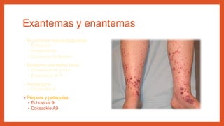 Exantemas y enantemas
• Erupciones maculopapulares
• Echovirus
• Inespecíficas
• Exantema de Boston
• Síndrome pie-mano-boca
• Coxsackie A6 y A16
• Enterovirus A71
• Herpangina
• Coxsackie A
• Púrpura y petequias
• Echovirus 9
• Coxsackie A9
 