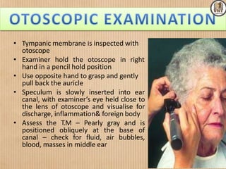 • Tympanic membrane is inspected with
otoscope
• Examiner hold the otoscope in right
hand in a pencil hold position
• Use opposite hand to grasp and gently
pull back the auricle
• Speculum is slowly inserted into ear
canal, with examiner’s eye held close to
the lens of otoscope and visualise for
discharge, inflammation& foreign body
• Assess the T.M – Pearly gray and is
positioned obliquely at the base of
canal – check for fluid, air bubbles,
blood, masses in middle ear
 