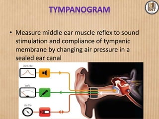 • Measure middle ear muscle reflex to sound
stimulation and compliance of tympanic
membrane by changing air pressure in a
sealed ear canal
 