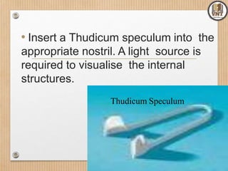 • Insert a Thudicum speculum into the
appropriate nostril. A light source is
required to visualise the internal
structures.
Thudicum Speculum
 
