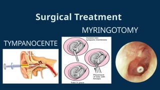 Ent Gp common ent problem in gp setting and primary care | PPTX