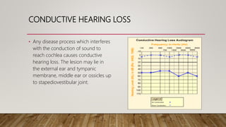 CONDUCTIVE HEARING LOSS
• Any disease process which interferes
with the conduction of sound to
reach cochlea causes conductive
hearing loss. The lesion may lie in
the external ear and tympanic
membrane, middle ear or ossicles up
to stapediovestibular joint.
 
