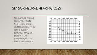 SENSORINEURAL HEARING LOSS
• Sensorineural hearing
loss (SNHL) results
from lesions of the
cochlea, VIIIth nerve or
central auditory
pathways. It may be
present at birth
(congenital) or start
later in life(acquired).
 