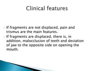 • If fragments are not displaced, pain and
trismus are the main features.
• If fragments are displaced, there is, in
addition, malocclusion of teeth and deviation
of jaw to the opposite side on opening the
mouth.
 