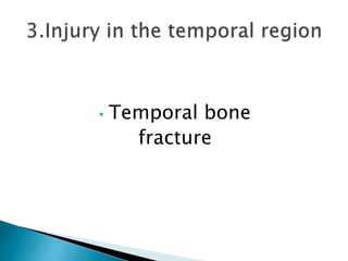 • Temporal bone
fracture
 