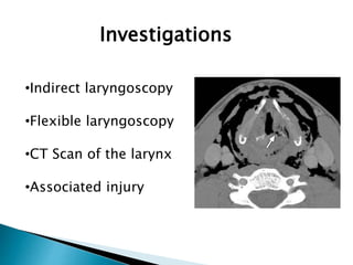 Investigations
•Indirect laryngoscopy
•Flexible laryngoscopy
•CT Scan of the larynx
•Associated injury
 