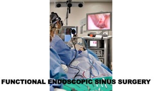 FUNCTIONAL ENDOSCOPIC SINUS SURGERY