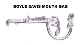 BOYLE DAVIS MOUTH GAG