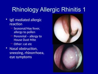 Ear Nose and throat Introduction with brief explanation | PPTX