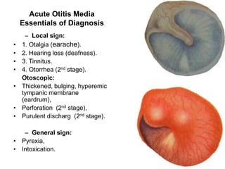 ENT LECTURES Combined.pdf