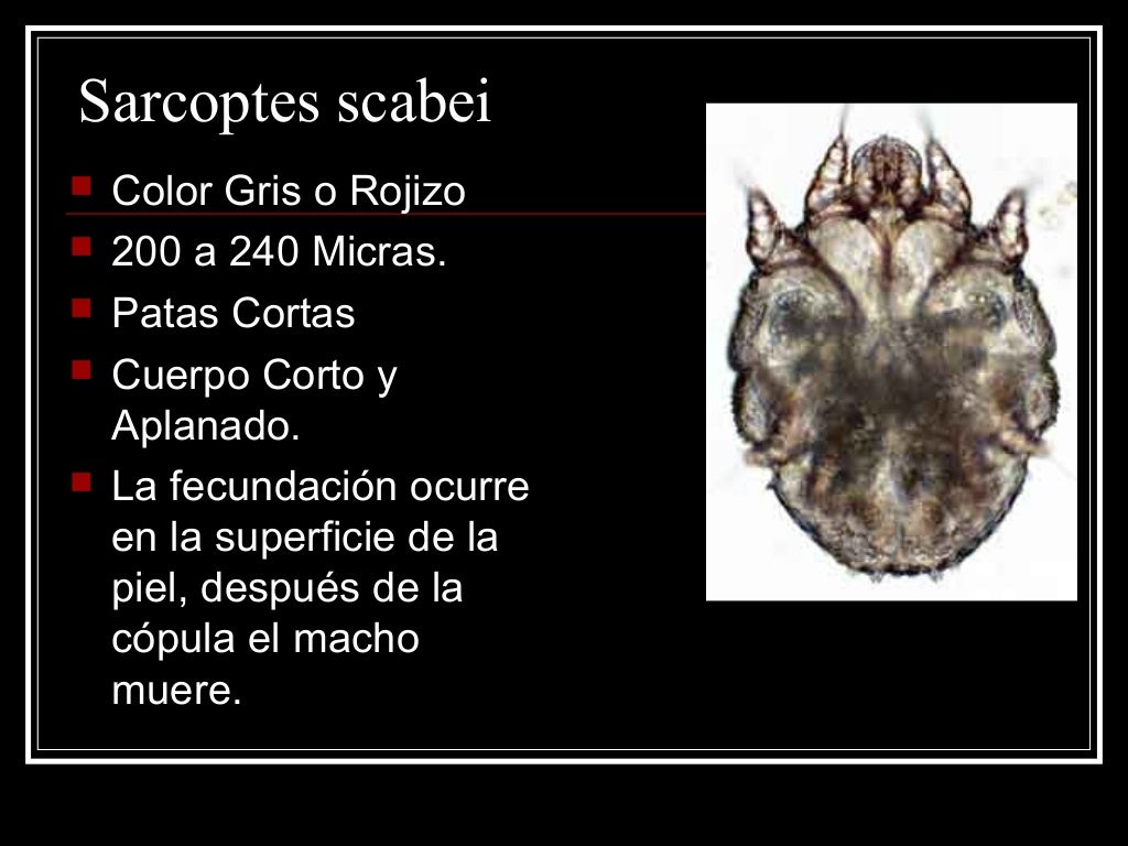 Entomología medica