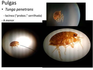 Pulgas
• Tunga penetrans
- lacínea (“proboc.” serrilhada)
- A menor
 